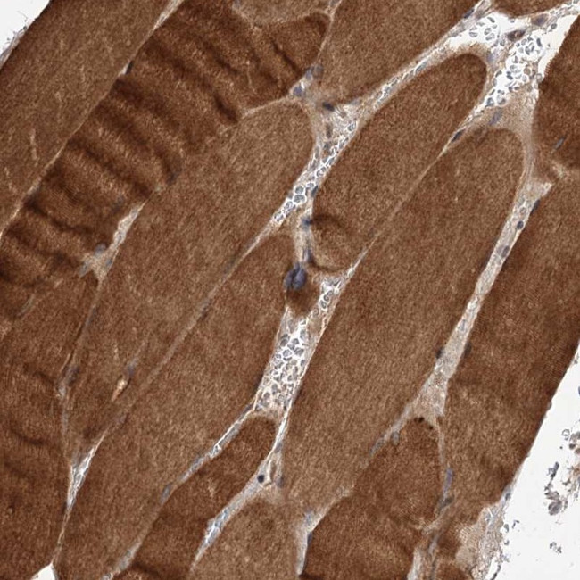 FBXW8 Antibody in Immunohistochemistry (IHC)