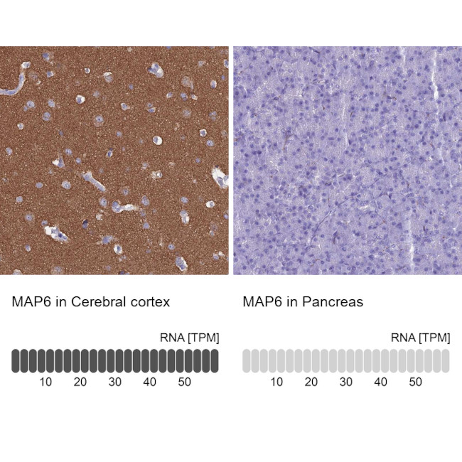 MAP6 Antibody in Immunohistochemistry (IHC)