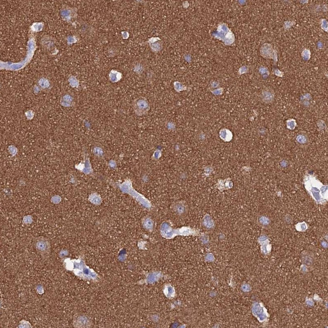 MAP6 Antibody in Immunohistochemistry (IHC)