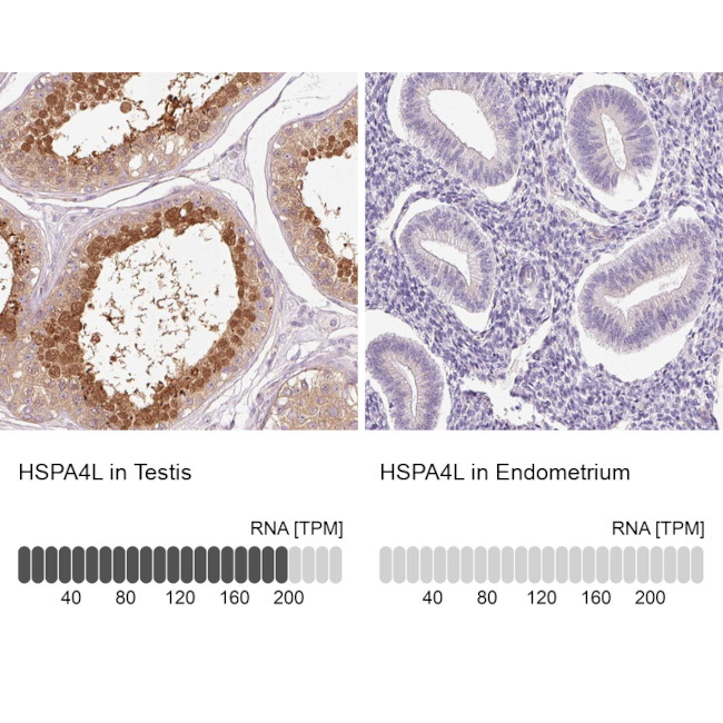 HSPA4L Antibody in Immunohistochemistry (IHC)