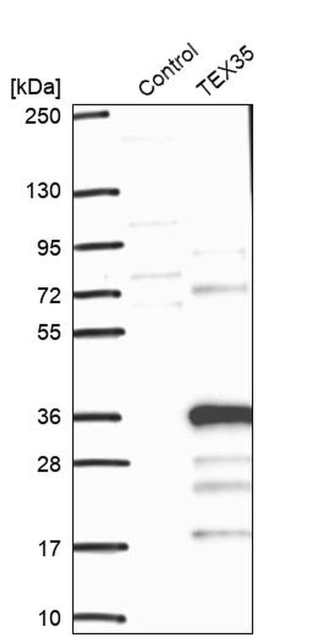 TEX35 Antibody in Western Blot (WB)