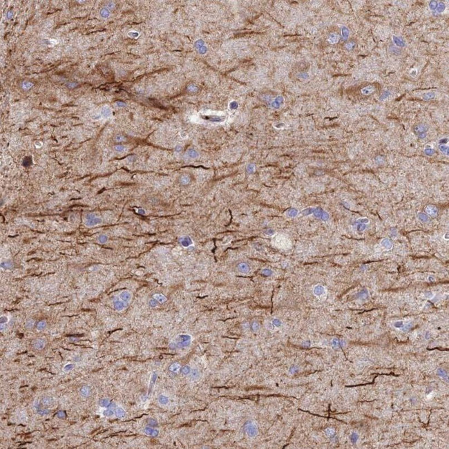 C10orf4 Antibody in Immunohistochemistry (IHC)