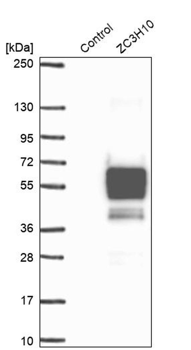 ZC3H10 Antibody in Western Blot (WB)