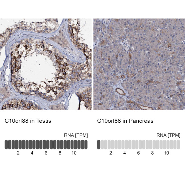 C10orf88 Antibody