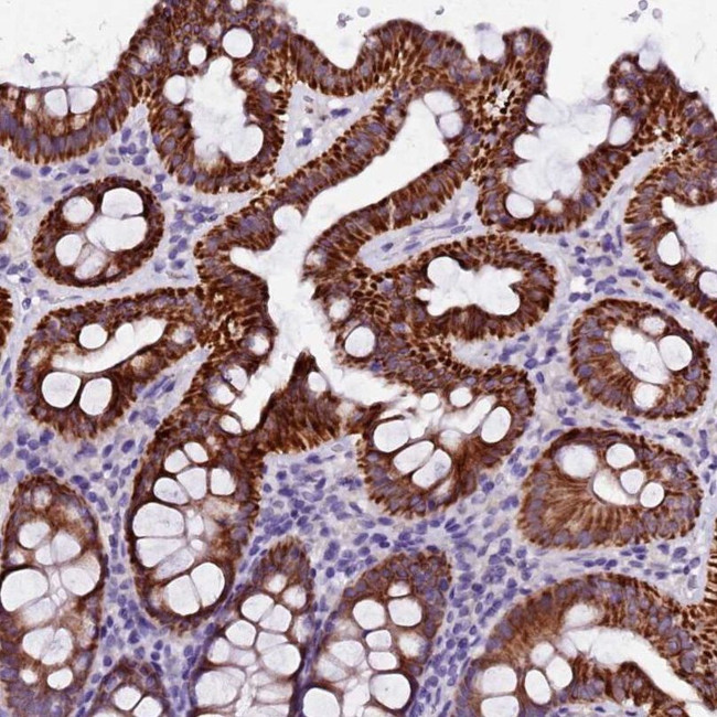 NAA16 Antibody in Immunohistochemistry (IHC)