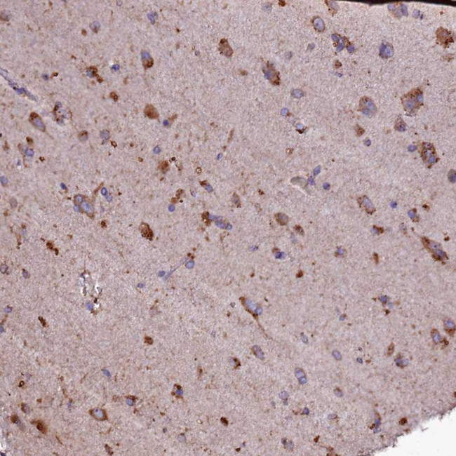 SELT Antibody in Immunohistochemistry (IHC)