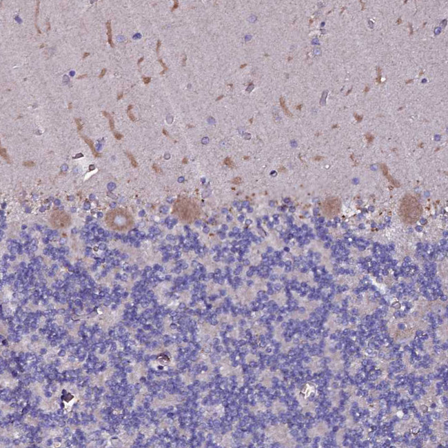 SELT Antibody in Immunohistochemistry (IHC)