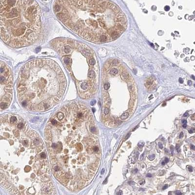 WDR61 Antibody in Immunohistochemistry (IHC)