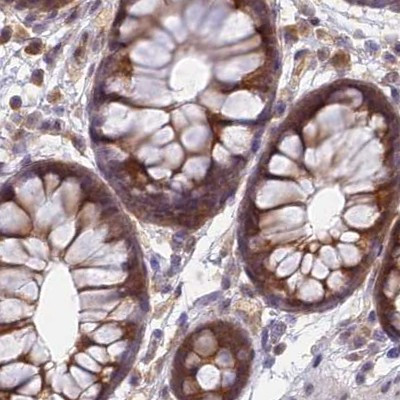 WDR61 Antibody in Immunohistochemistry (IHC)