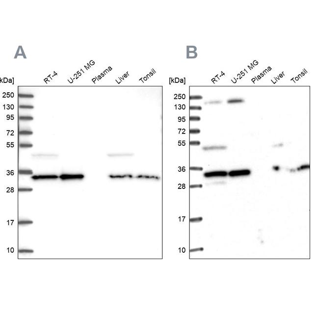 WDR61 Antibody in Western Blot (WB)