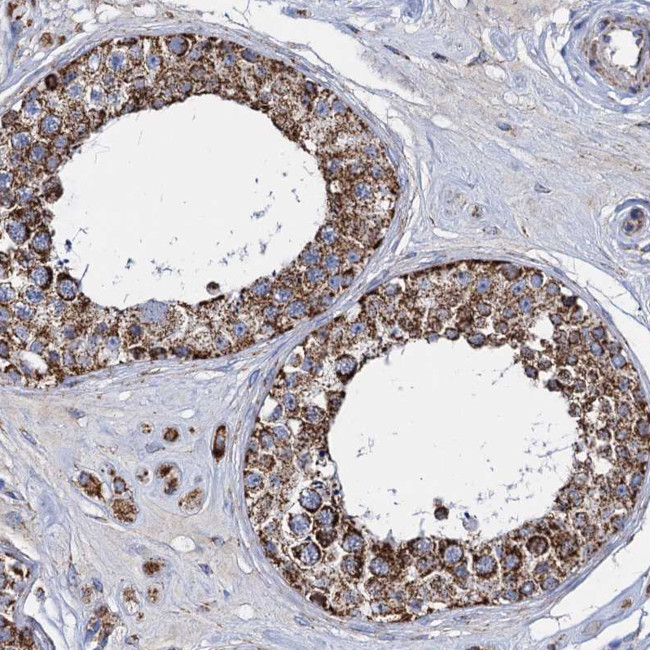 TIMM10 Antibody in Immunohistochemistry (IHC)