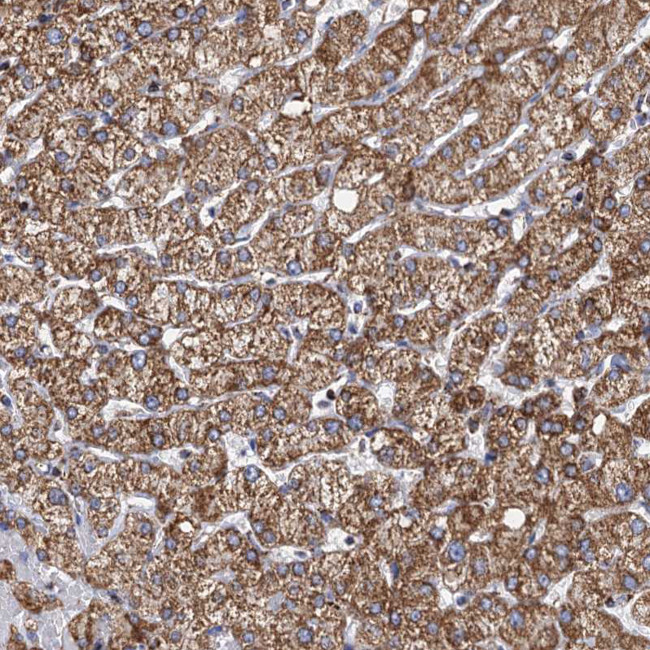 TIMM10 Antibody in Immunohistochemistry (IHC)