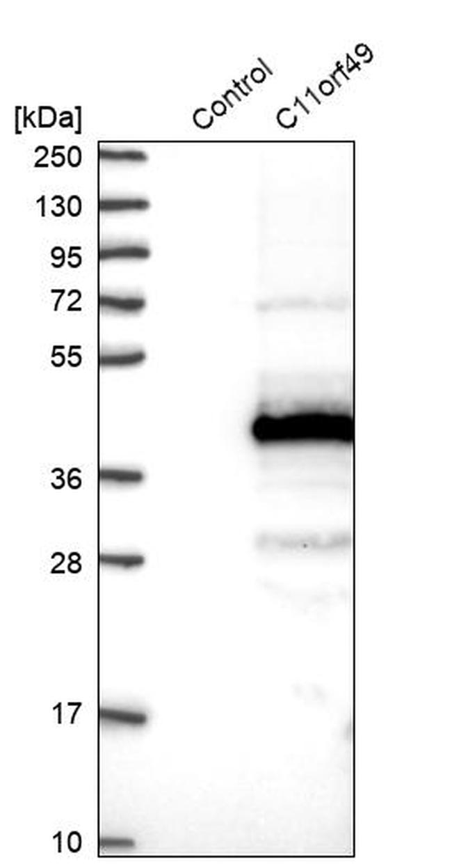 C11orf49 Antibody in Western Blot (WB)