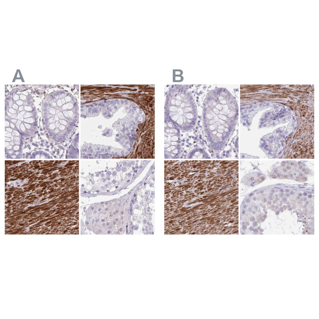 SYNM Antibody in Immunohistochemistry (IHC)