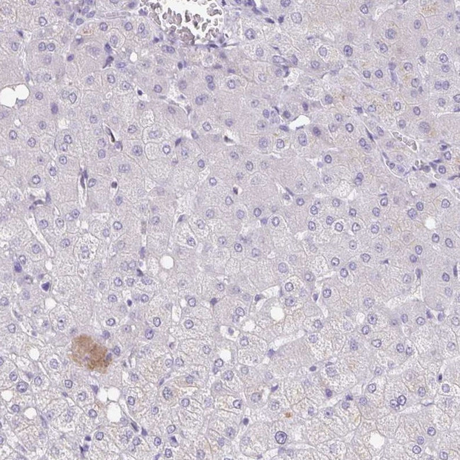 SYNM Antibody in Immunohistochemistry (IHC)