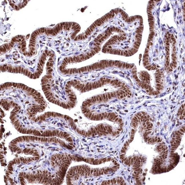 RSRC2 Antibody in Immunohistochemistry (IHC)