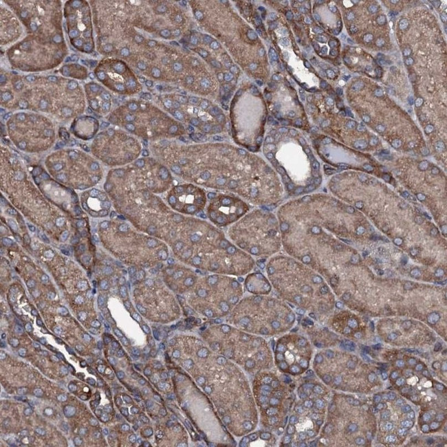 USPL1 Antibody in Immunohistochemistry (IHC)