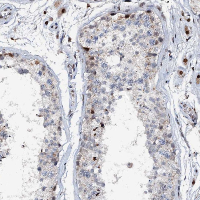 ABCG4 Antibody in Immunohistochemistry (Paraffin) (IHC (P))