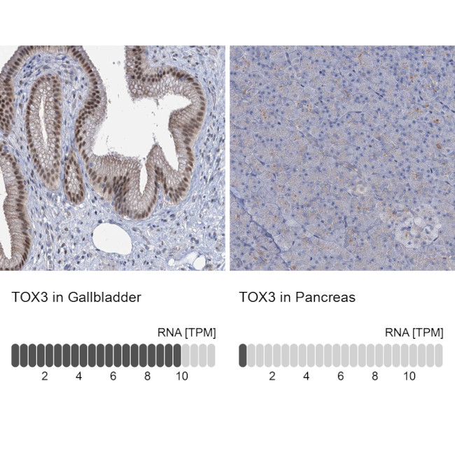 TOX3 Antibody in Immunohistochemistry (IHC)