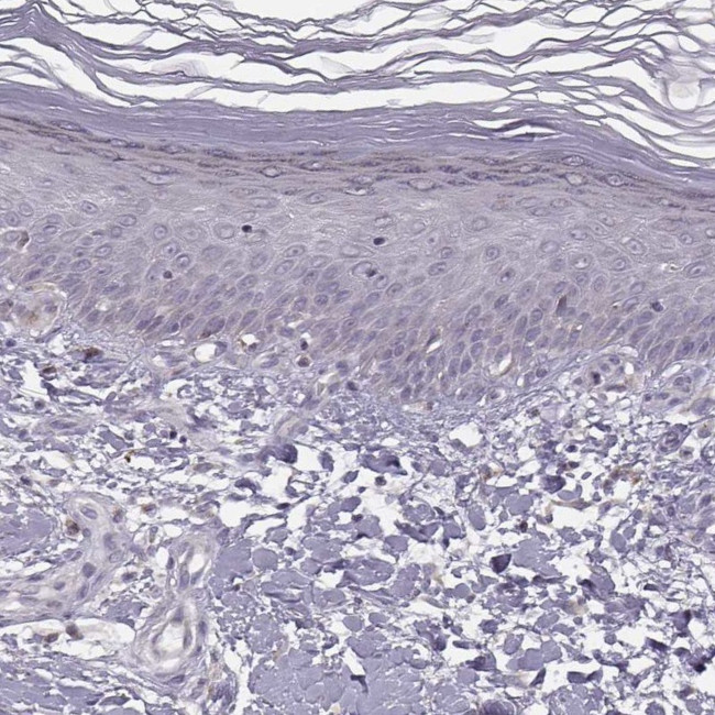 ACSL6 Antibody in Immunohistochemistry (IHC)