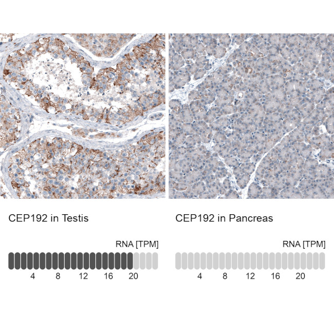 CEP192 Antibody in Immunohistochemistry (IHC)