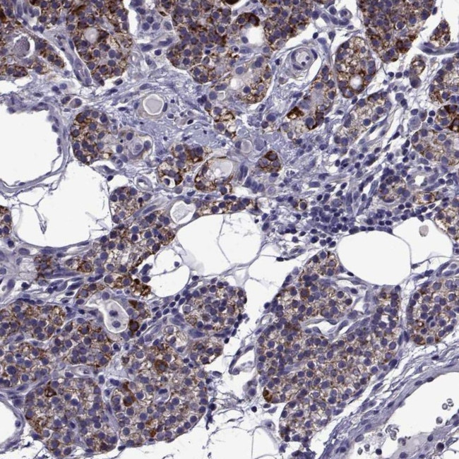 TMC3 Antibody in Immunohistochemistry (IHC)