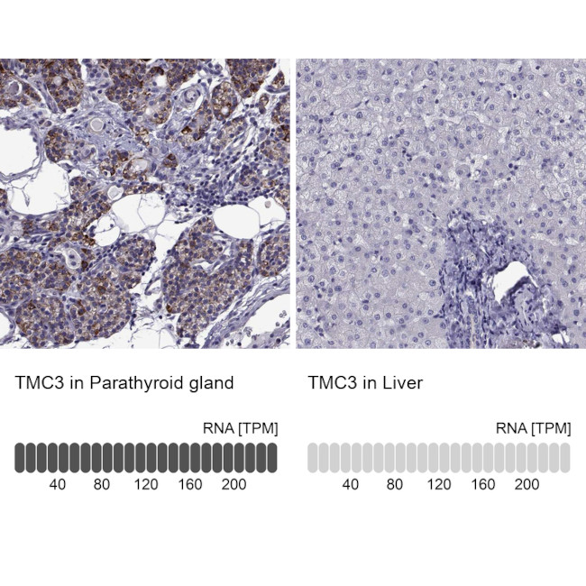 TMC3 Antibody