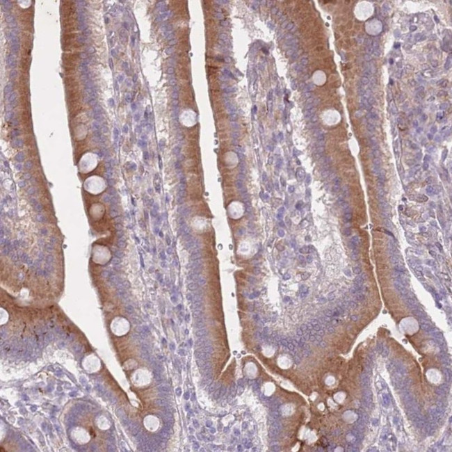 ARPIN Antibody in Immunohistochemistry (IHC)