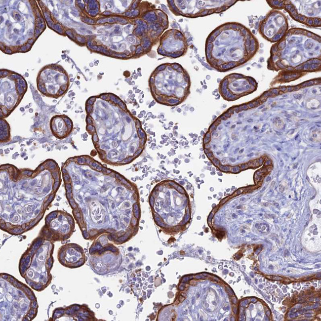 MYO5B Antibody in Immunohistochemistry (IHC)