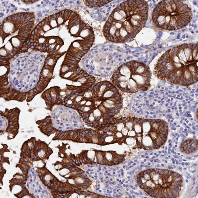 MYO5B Antibody in Immunohistochemistry (IHC)