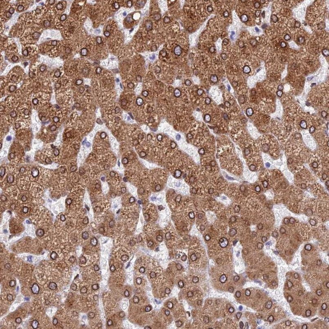 TMPRSS7 Antibody in Immunohistochemistry (IHC)