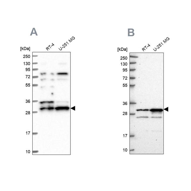 HAUS1 Antibody in Western Blot (WB)