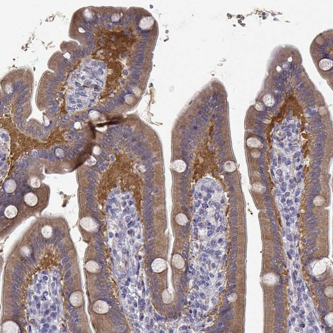 CREB3L3 Antibody in Immunohistochemistry (IHC)