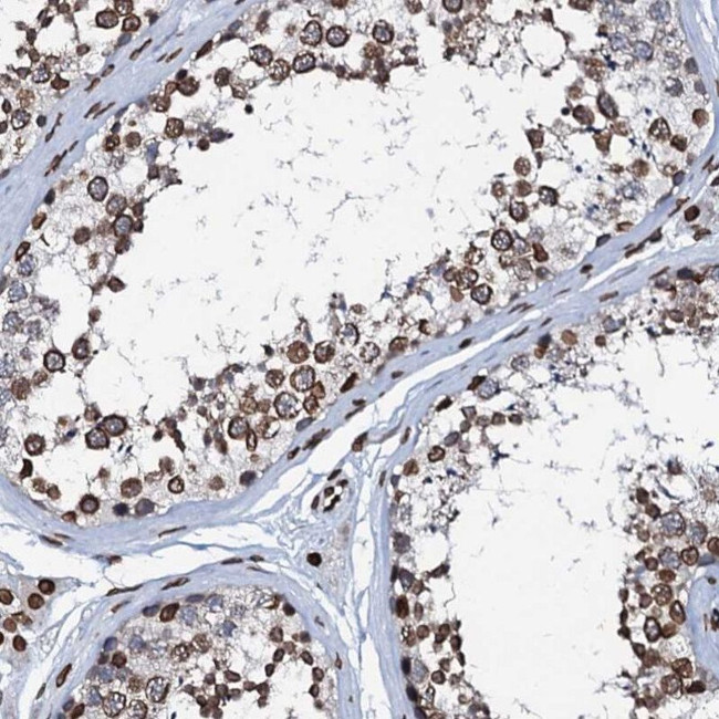 KATNAL2 Antibody in Immunohistochemistry (IHC)