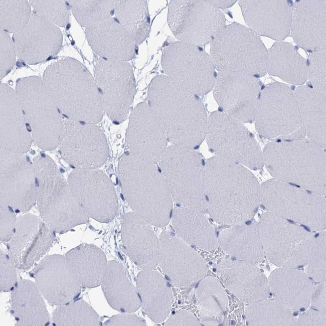 CALML5 Antibody in Immunohistochemistry (IHC)