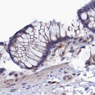 RNH1 Antibody in Immunohistochemistry (IHC)