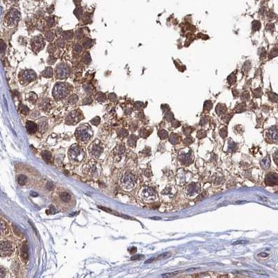 RNH1 Antibody in Immunohistochemistry (IHC)