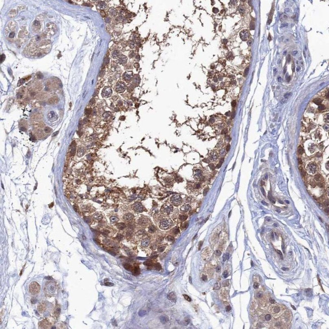 RNH1 Antibody in Immunohistochemistry (IHC)