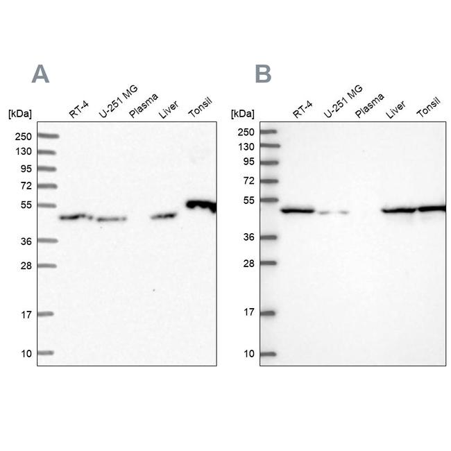 RNH1 Antibody in Western Blot (WB)