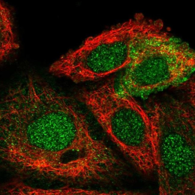 STRA6 Antibody in Immunocytochemistry (ICC/IF)