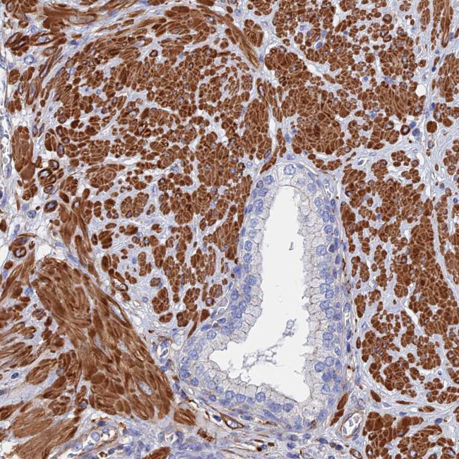 STRA6 Antibody in Immunohistochemistry (IHC)