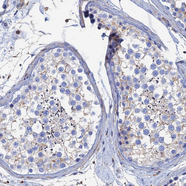 STRA6 Antibody in Immunohistochemistry (IHC)