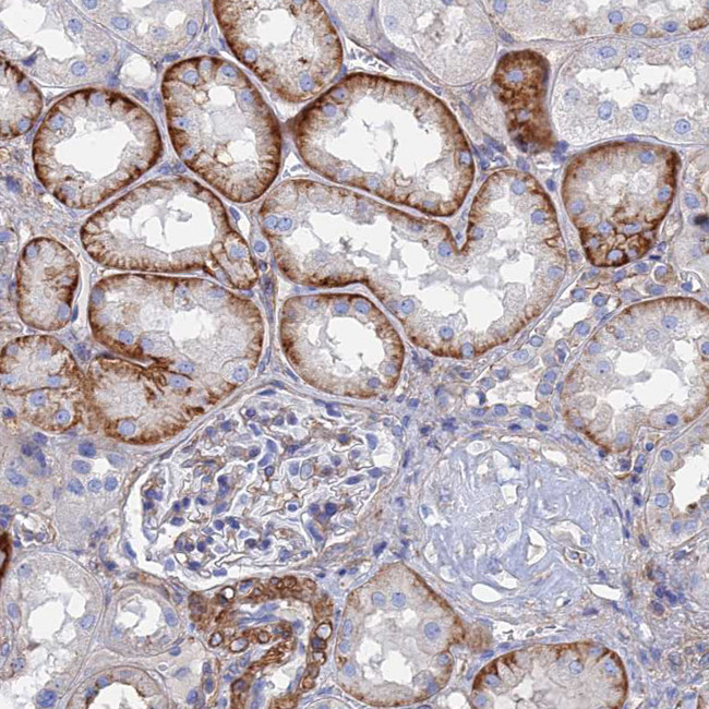 STRA6 Antibody in Immunohistochemistry (IHC)