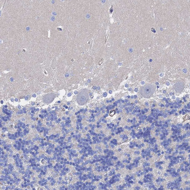 STRA6 Antibody in Immunohistochemistry (IHC)