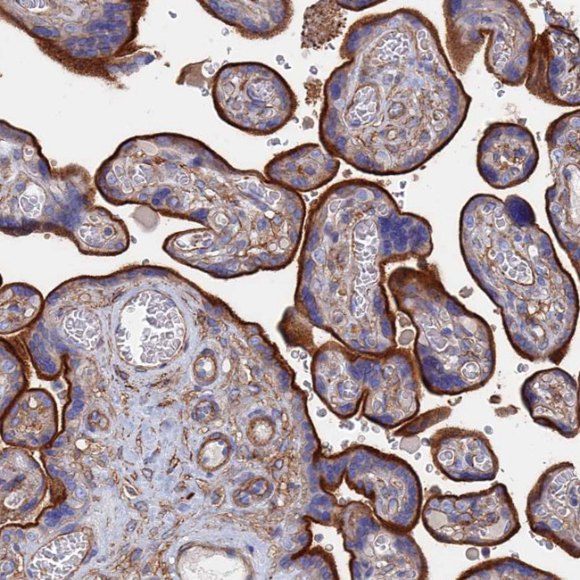 STRA6 Antibody in Immunohistochemistry (IHC)