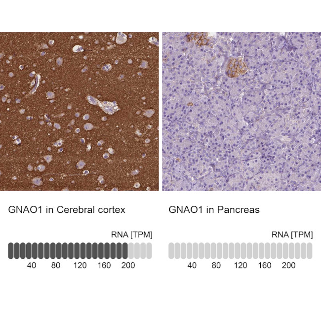 GNAO1 Antibody in Immunohistochemistry (IHC)