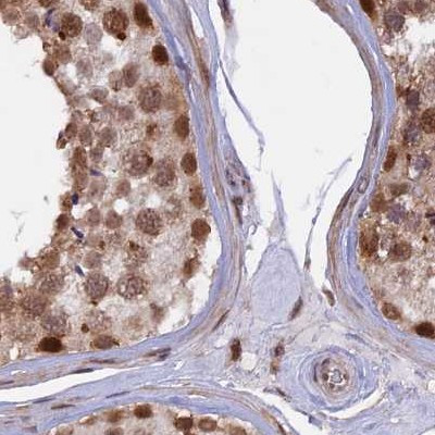 POLR2C Antibody in Immunohistochemistry (IHC)