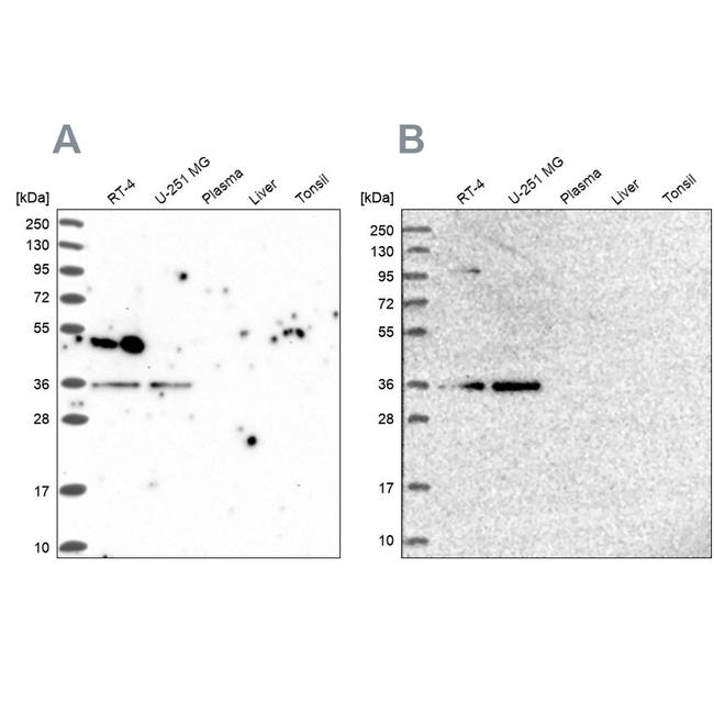 POLR2C Antibody in Western Blot (WB)