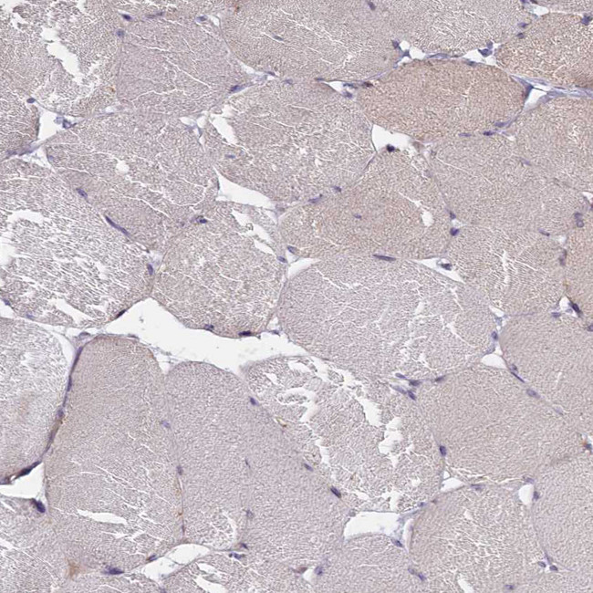 ALS Antibody in Immunohistochemistry (IHC)