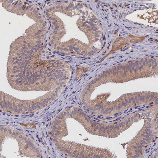 ALS Antibody in Immunohistochemistry (IHC)